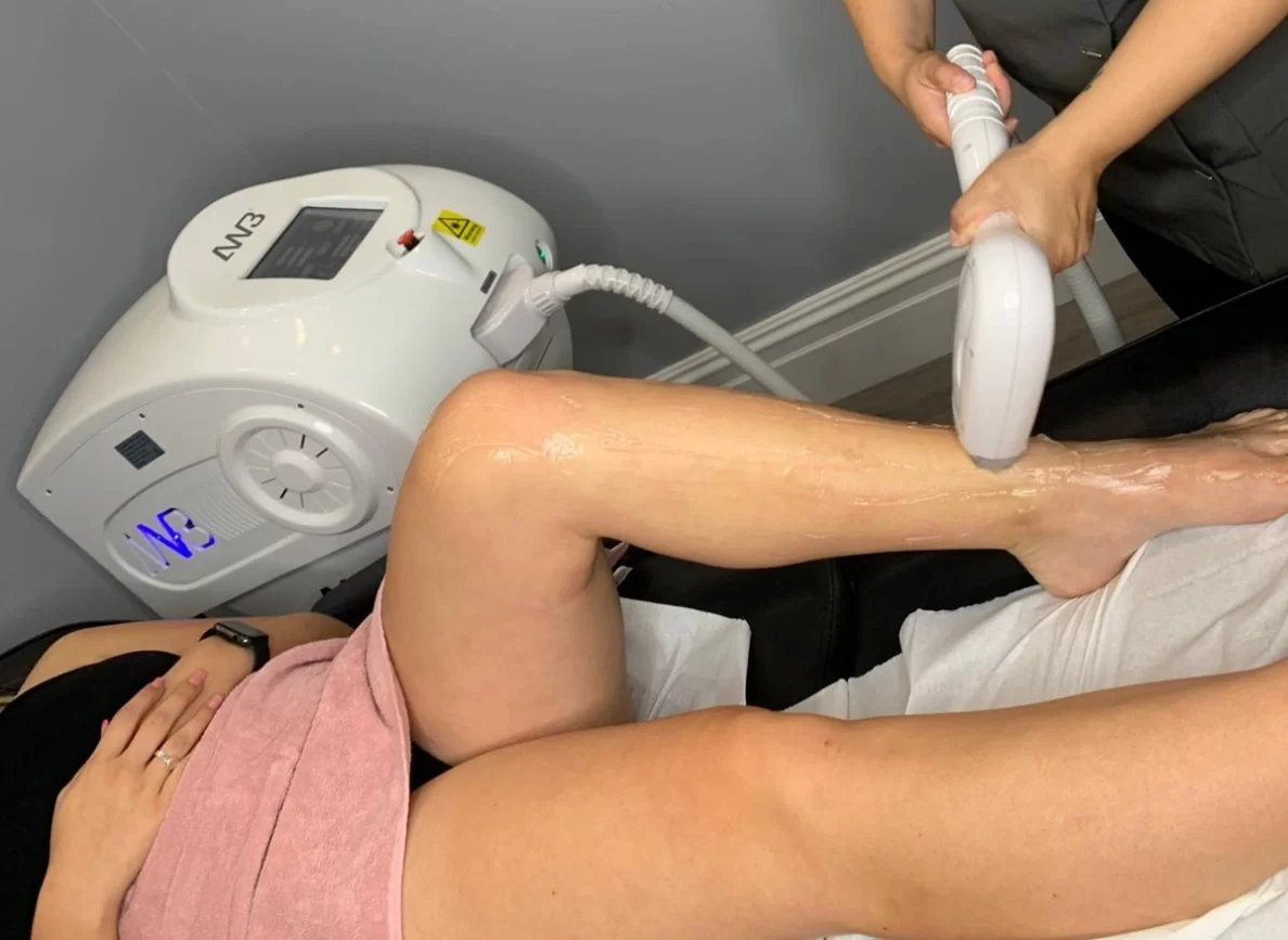 Laser Hair Removal Lydiate