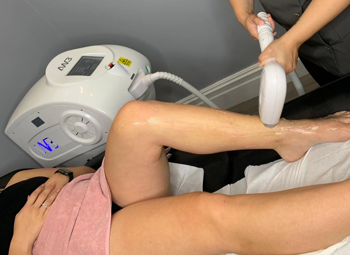 Laser Hair Removal Lydiate